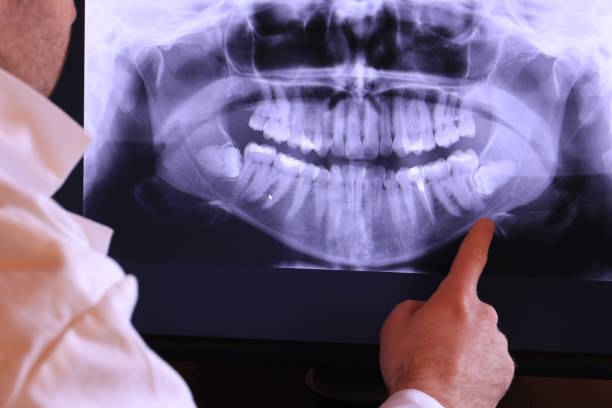 Best Emergency Tooth Extraction in Two Rivers, WI