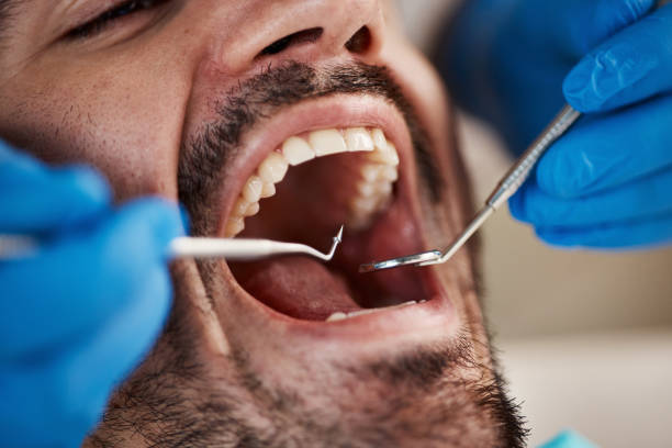 Best Emergency Treatment for Dental Infections or Abscesses in Two Rivers, WI