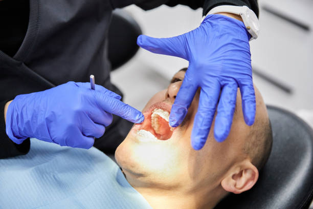 Best Emergency Root Canal Treatment in Two Rivers, WI